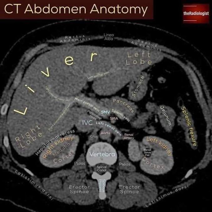 CT Abdomen Anatomy