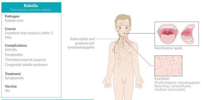 Cause of rubella syndrome