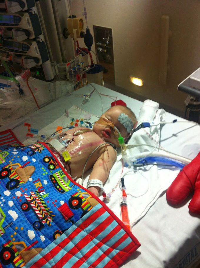Pediatric open heart surgery