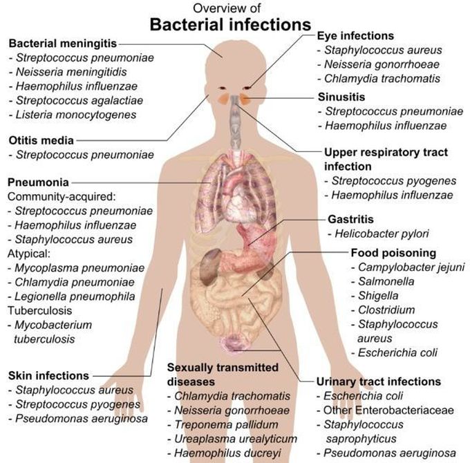 Overview of bacterial infections
