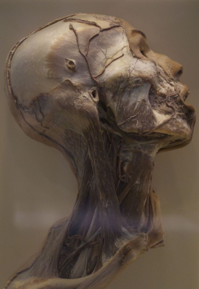 Preserved human head