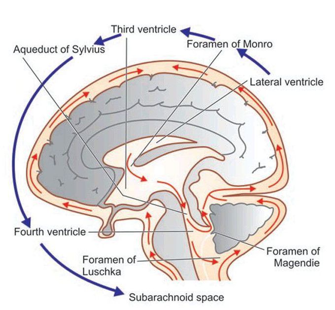 Normal circulation of CSF.