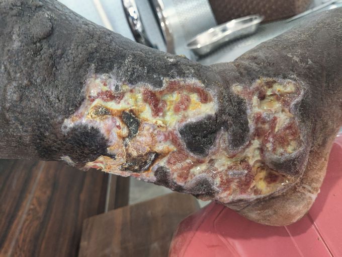 Diagnosis?