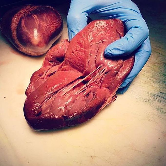 Say hello to chordae tendinae and papillary muscles
