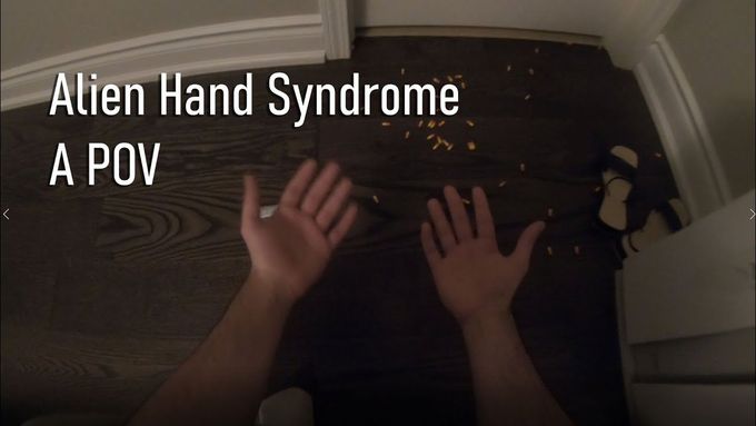 Alien Hand Syndrome - A POV
