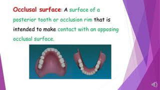 Occlusal surface of denture
