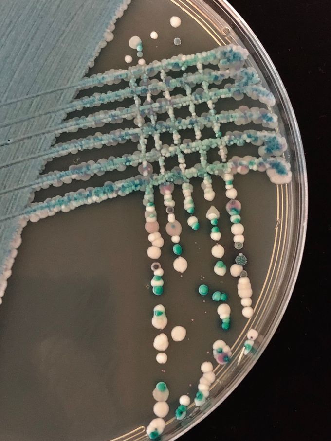 Candida albicans, Candida tropicalis, Candida glabrata, Candida krusei and Candida dubliniensis are isolated from the patients. They mixed and inoculated to Chromatic ™ Candida agar. You can see colorful colonies of Candida species.