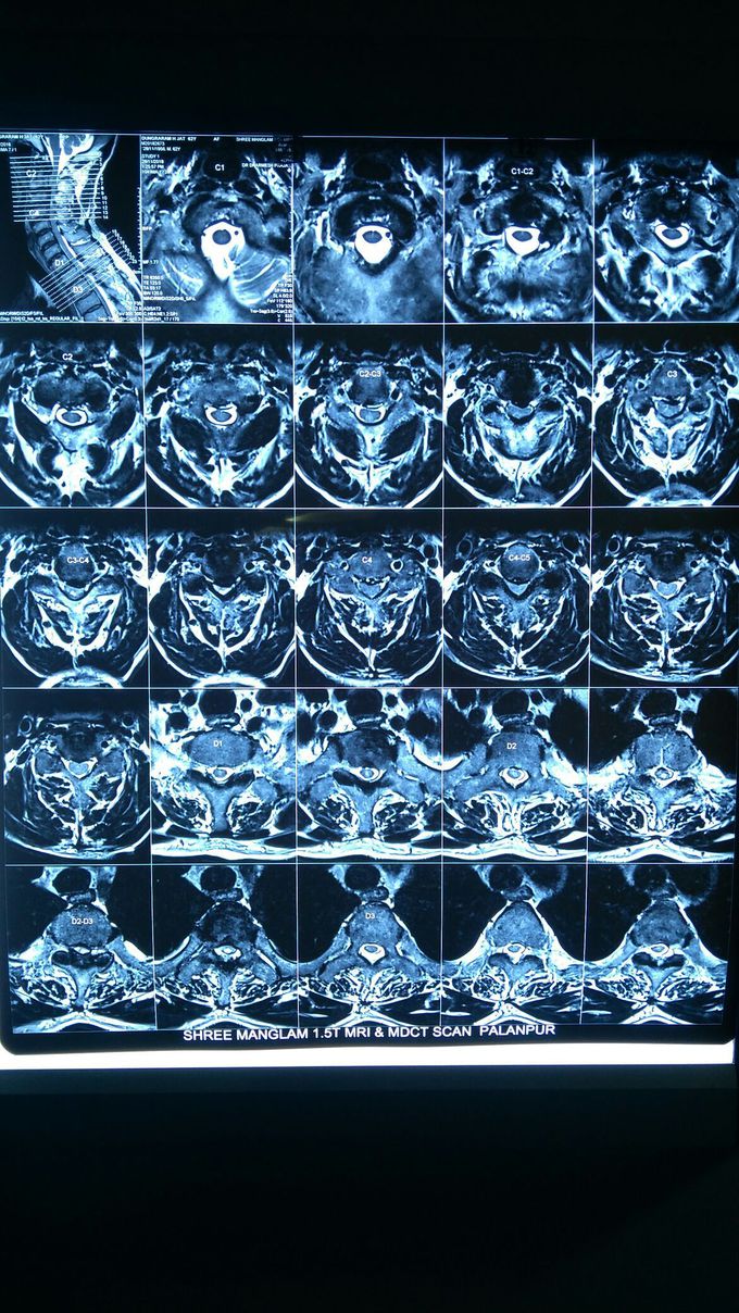 Diagnosis