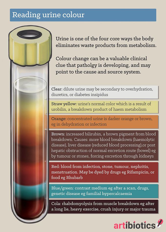 Reading urine colour