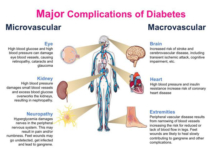 Complication of DM