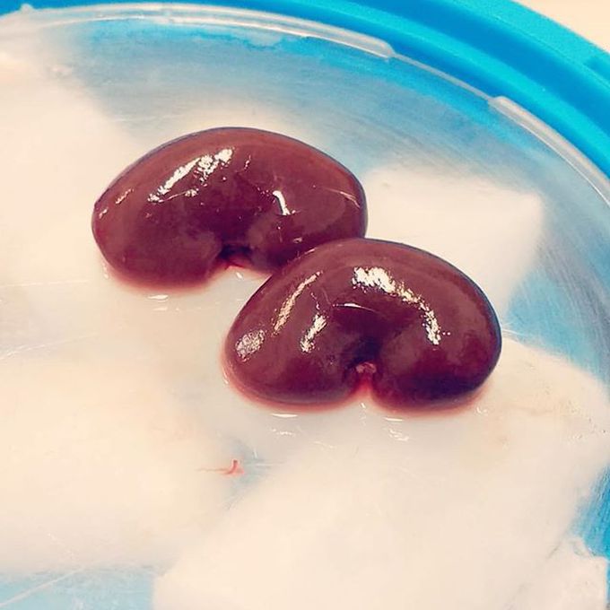 Kidneys! 