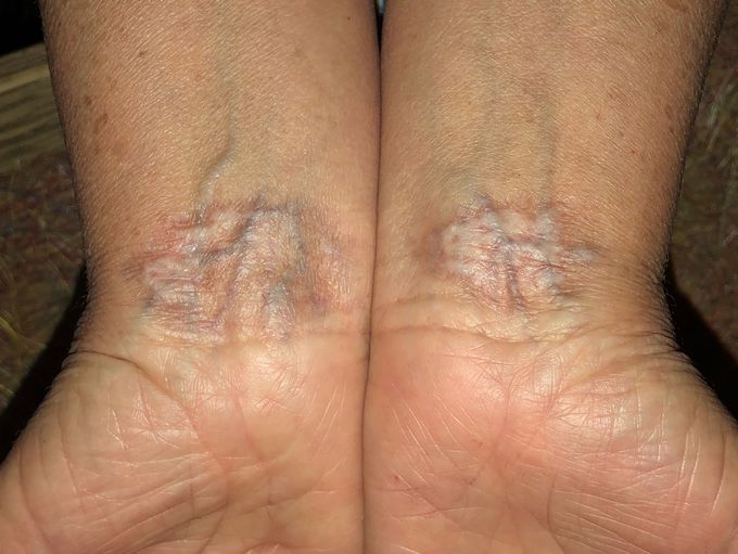 Skin and vascular changes