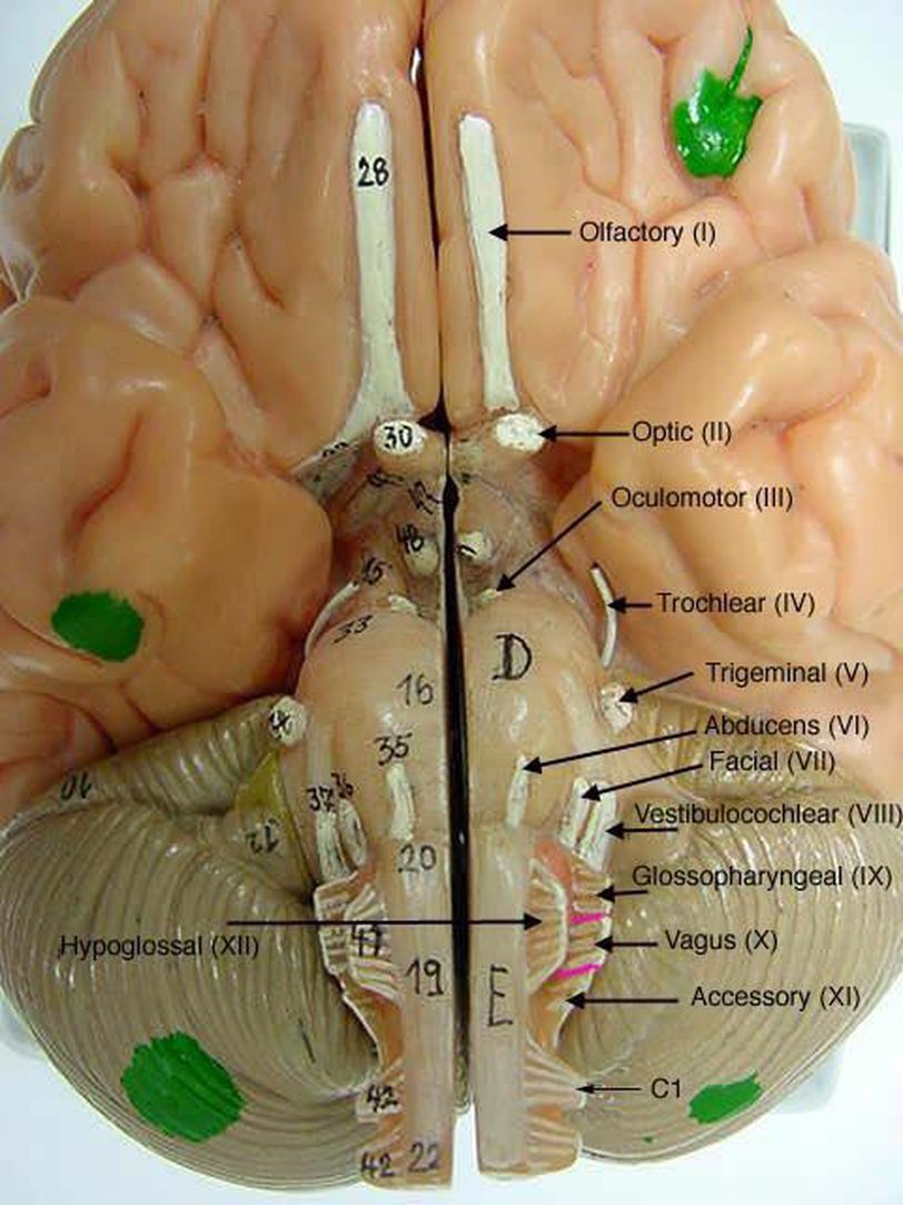 BRAIN - MEDizzy