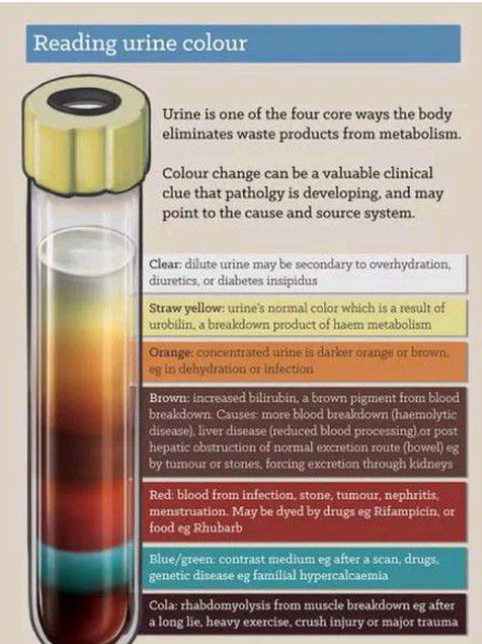 Urine rainbow 😂🌈
