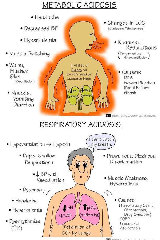 Metabolic Acidosis vs Respiratory Acidosis