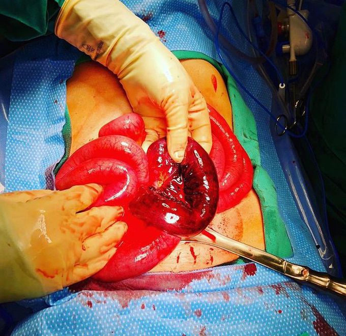 What is your diagnosis ??