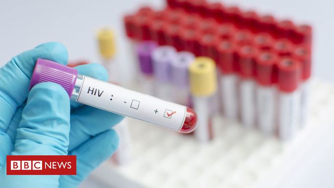 HIV vaccine shows promise in human trial
