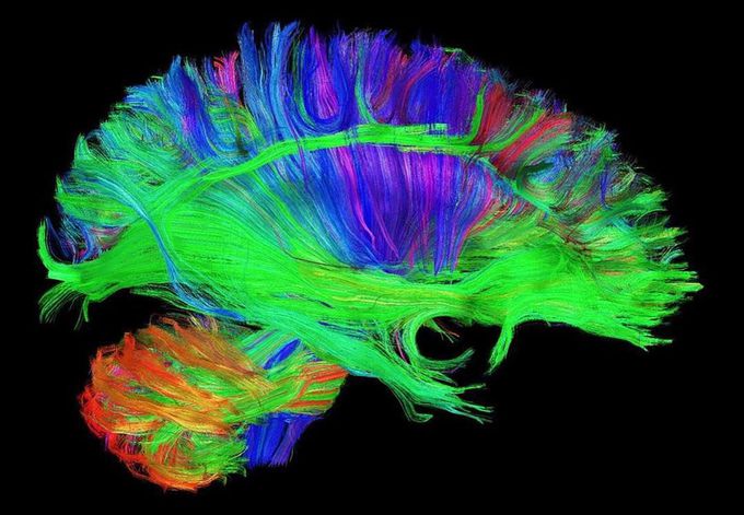 DSI tractography!