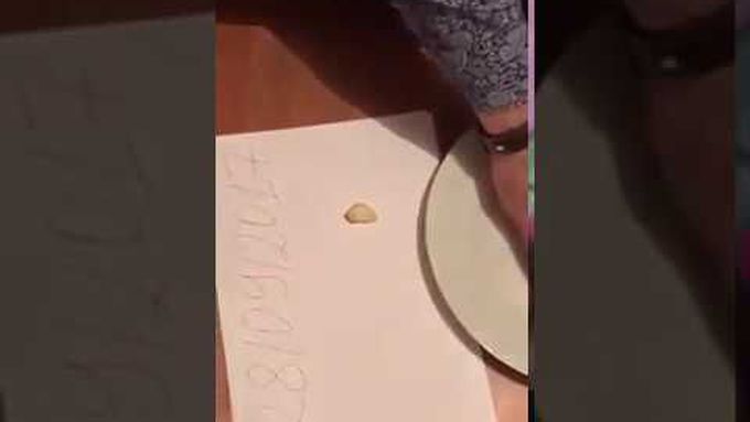 Malignant Cancer Cell Reacting To Garlic and Gold