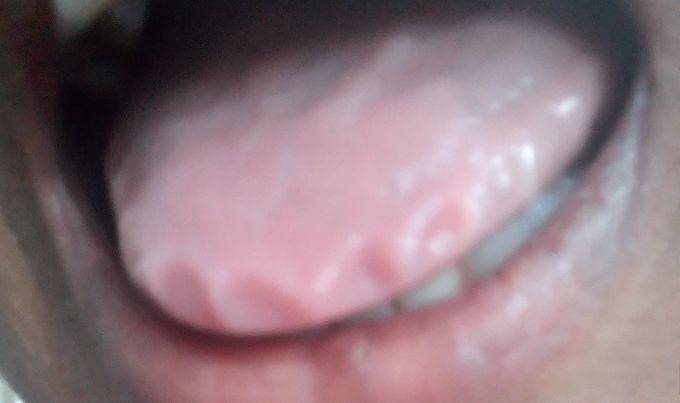 Tounge