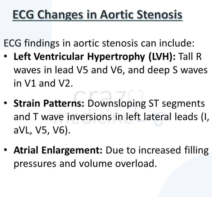 Aortic Stenosis VII