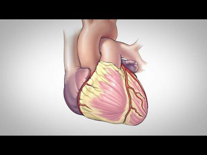 Coronary artery bypass graft- Insight