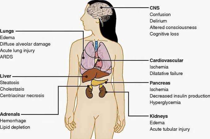 These are the symptoms of Multiple organ dysfunction syndrome