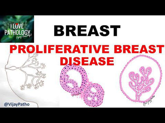 Breast Pathologies Part 2