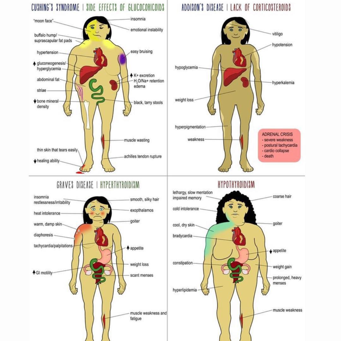 Disease process