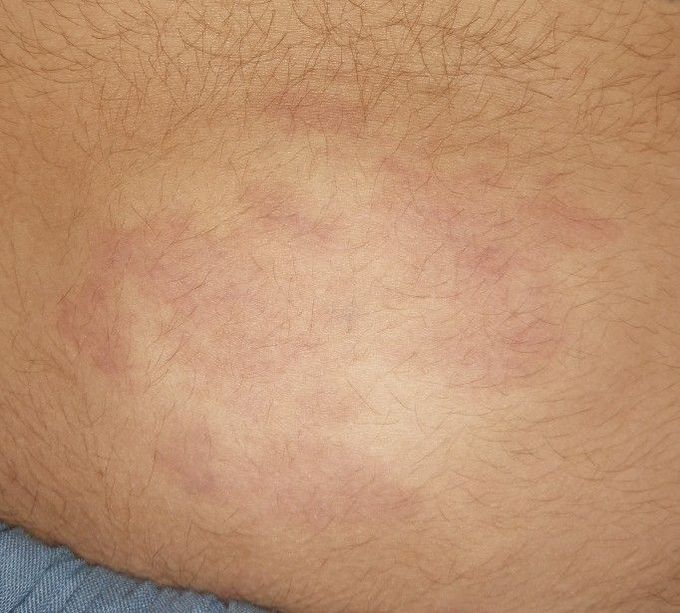 Diagnose Please.