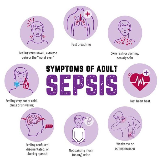 Symptons of sepsis.