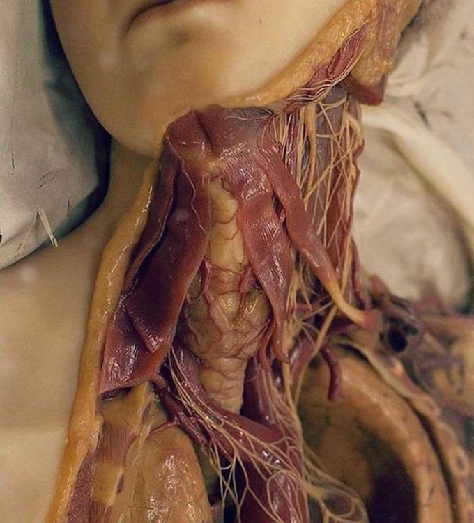 The most important thing is that the oesophagues and the pharynx were operated very dipily the arteries Carey bloods vessels