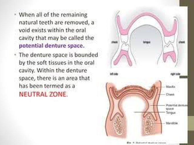 Neutral zone