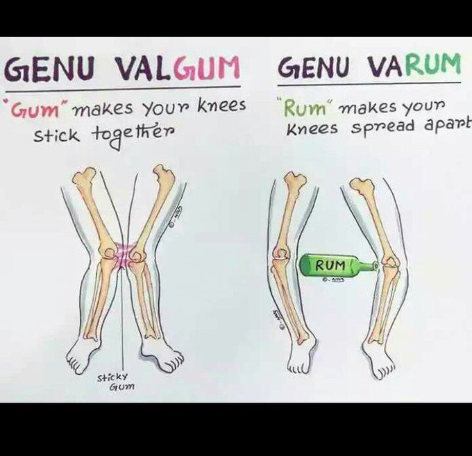 Valgum & varum
