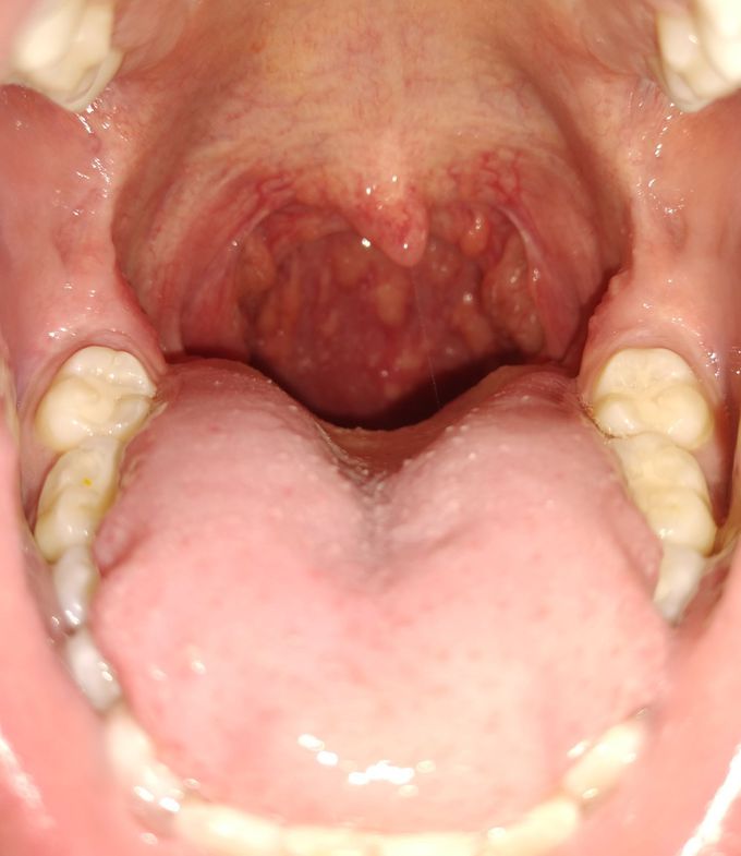 Does anyone know what this could be,  lasting months now