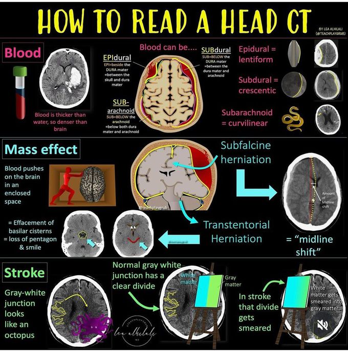 How to read CT