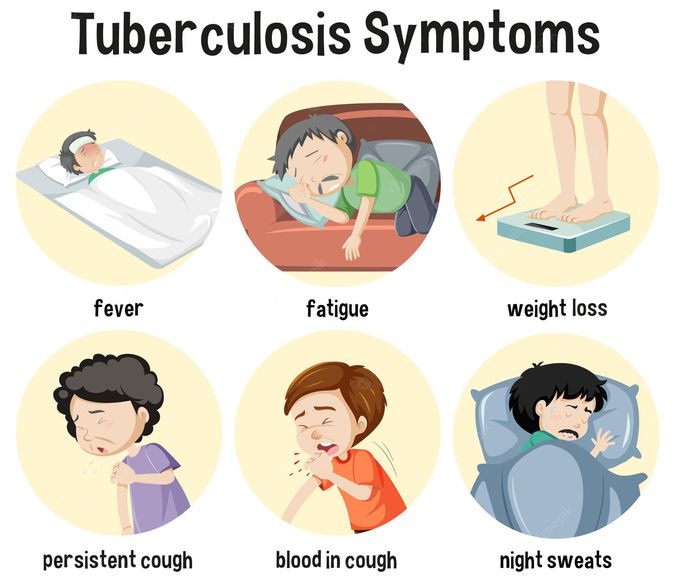 Symptoms of TB