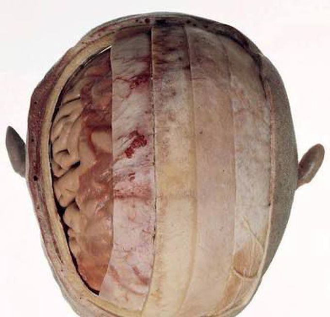 Layers of scalp...