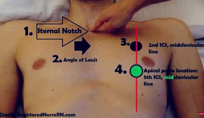 Apical pulse