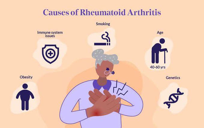 Causes of rheumatoid arthritis