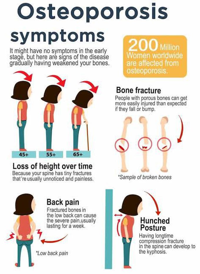These are the symptoms of osteoporosis