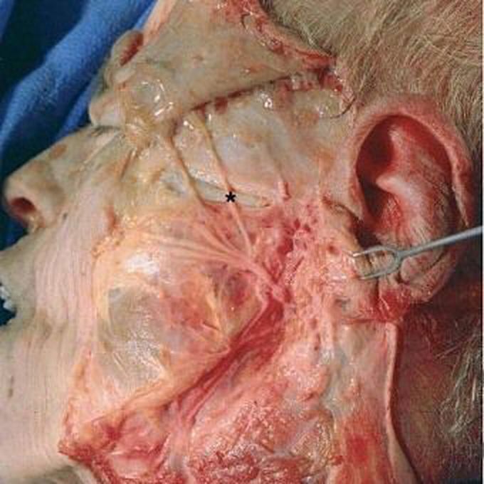 Branches of facial nerve