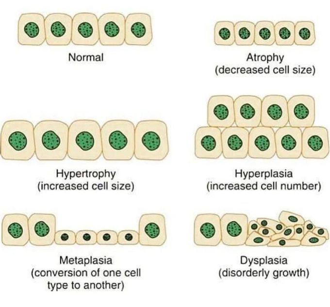 Cellular Adaptations