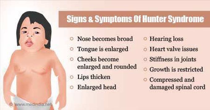 These are the symptoms of Hunter syndrome