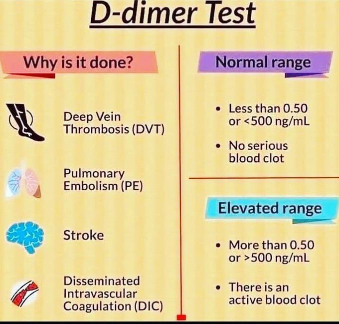D-Dimer Test