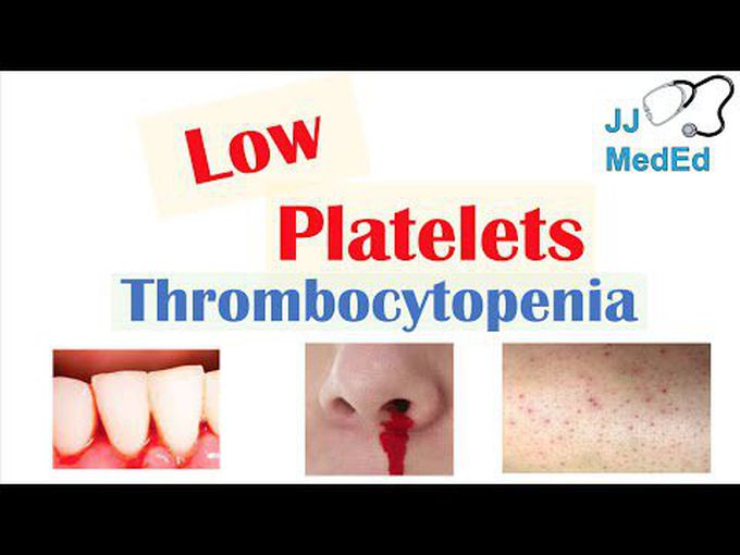 Descriptive pathology of Thrombocytopenia