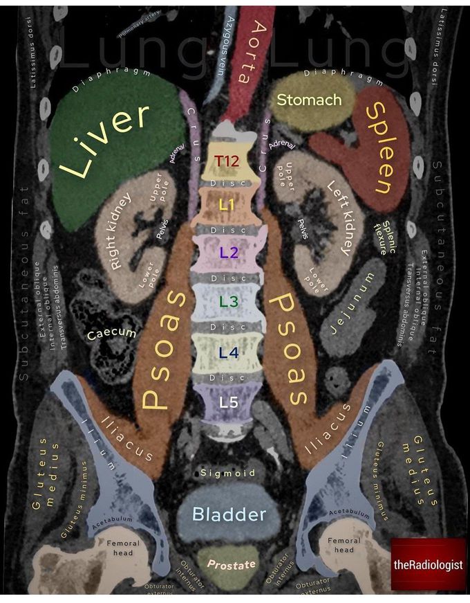 CT Abdomen and Pelvis