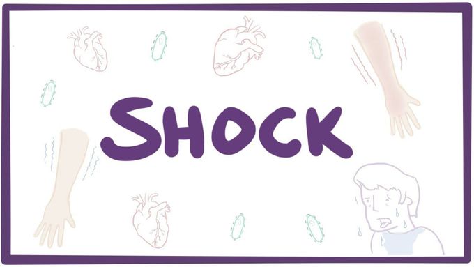Shock - causes, symptoms, diagnosis, treatment, pathology