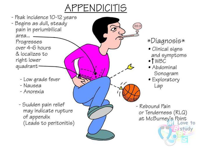 APPENDICITIS MEDizzy