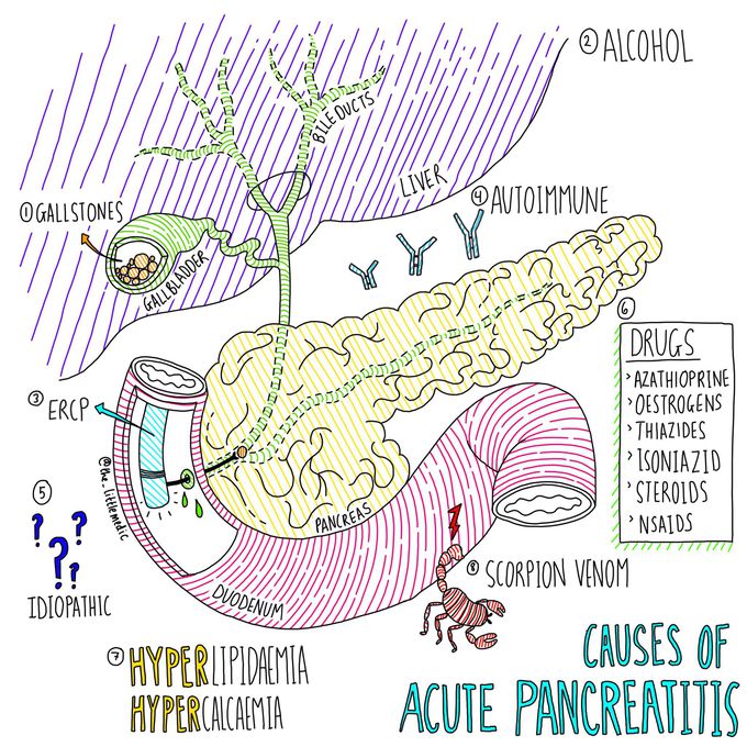 Acute pancreatitis